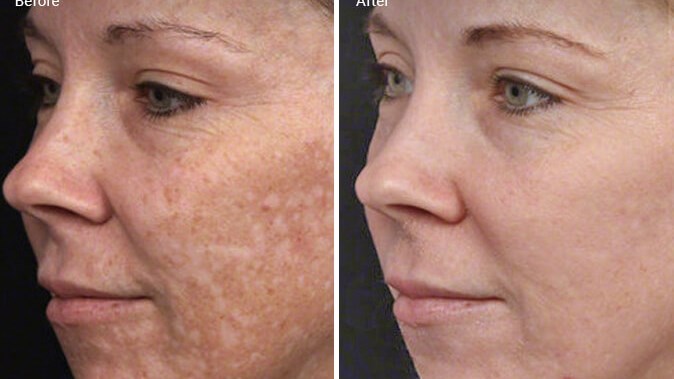 Before and after photo: Post a